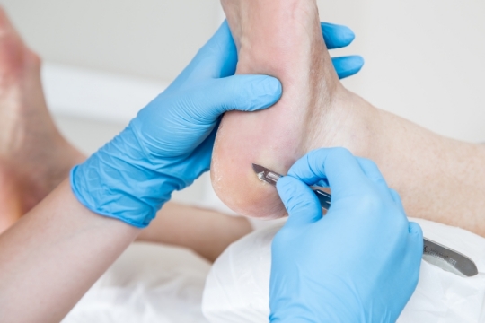 Podologische Behandlung